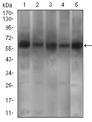 PDE1B Antibody - Western blot using PDE1B mouse monoclonal antibody against A549 (1), SK-MES-1 (2), PC-12 (4),3T3L1 (5) cell lysate and Mouse brain (3) tissue lysate.