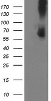 PDE1B Antibody - HEK293T cells were transfected with the pCMV6-ENTRY control (Left lane) or pCMV6-ENTRY PDE1B (Right lane) cDNA for 48 hrs and lysed. Equivalent amounts of cell lysates (5 ug per lane) were separated by SDS-PAGE and immunoblotted with anti-PDE1B.