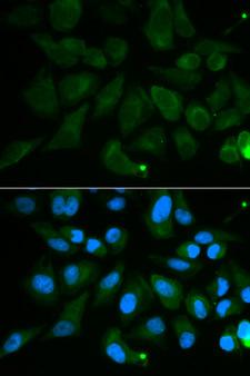 PDE1B Antibody - Immunofluorescence analysis of MCF7 cell using PDE1B antibody. Blue: DAPI for nuclear staining.