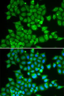 PDE1B Antibody - Immunofluorescence analysis of U2OS cells.