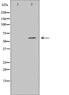 PDE1B Antibody - Western blot analysis of mouse brain lysate using PDE1B antibody. The lane on the left is treated with the antigen-specific peptide.