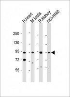 PDE1C Antibody - All lanes: Anti-PDE1C Antibody (Center) at 1:1000-2000 dilution. Lane 1: human heart lysate. Lane 2: mouse testis lysate. Lane 3: rat kidney lysate. Lane 4: NCI-H460 whole cell lysate Lysates/proteins at 20 ug per lane. Secondary Goat Anti-Rabbit IgG, (H+L), Peroxidase conjugated at 1:10000 dilution. Predicted band size: 81 kDa. Blocking/Dilution buffer: 5% NFDM/TBST.