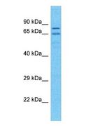 PDE1C Antibody - Western blot of PDE1C Antibody with human Placenta lysate.  This image was taken for the unconjugated form of this product. Other forms have not been tested.