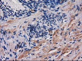 PDE2A Antibody - IHC of paraffin-embedded Human prostate tissue using anti-PDE2A mouse monoclonal antibody.
