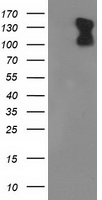 PDE2A Antibody - HEK293T cells were transfected with the pCMV6-ENTRY control (Left lane) or pCMV6-ENTRY PDE2A (Right lane) cDNA for 48 hrs and lysed. Equivalent amounts of cell lysates (5 ug per lane) were separated by SDS-PAGE and immunoblotted with anti-PDE2A.