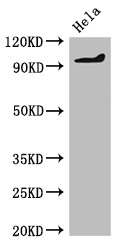 PDE2A Antibody - Positive WB detected in:Hela whole cell lysate;All lanes:PDE2A antibody at 2?g/ml;Secondary;Goat polyclonal to rabbit IgG at 1/50000 dilution;Predicted band size: 106,104,105,79,88 KDa;Observed band size: 106 KDa;