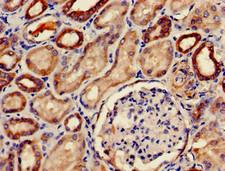 PDE2A Antibody - Immunohistochemistry of paraffin-embedded human kidney tissue using PDE2A Antibody at dilution of 1:100
