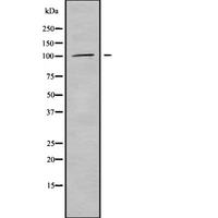 PDE2A Antibody - Western blot analysis of PDE2A using LOVO cells whole cells lysates