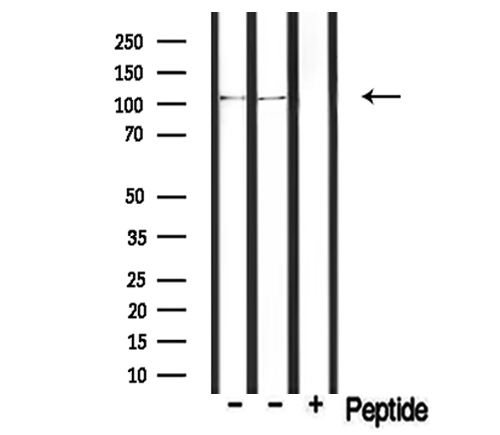 PDE2A Antibody - Western blot analysis of extracts of rat muscle and mouse brain tissue using PDE2A antibody.