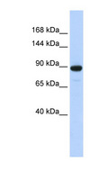 PDE3A Antibody - PDE3A antibody Western blot of MCF7 cell lysate. This image was taken for the unconjugated form of this product. Other forms have not been tested.