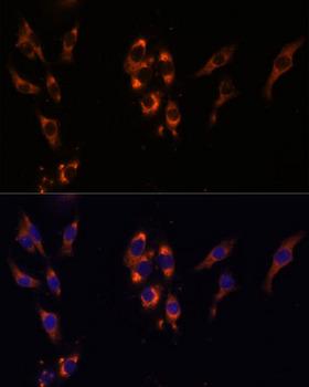 PDE3A Antibody - Immunofluorescence analysis of HeLa cells using PDE3A Polyclonal Antibody at dilution of 1:100 (40x lens).Blue: DAPI for nuclear staining.