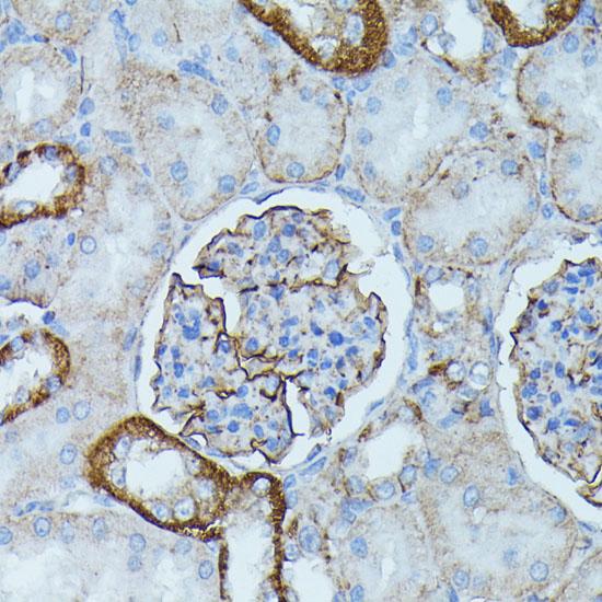 PDE3A Antibody - Immunohistochemistry of paraffin-embedded Rat kidney using PDE3A Polyclonal Antibody at dilution of 1:100 (40x lens).