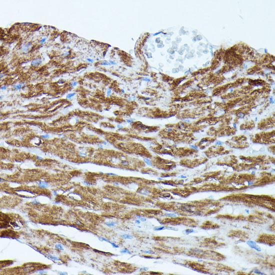 PDE3A Antibody - Immunohistochemistry of paraffin-embedded Mouse heart using PDE3A Polyclonal Antibody at dilution of 1:100 (40x lens).