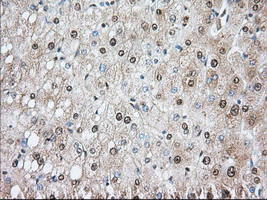 PDE4A / PDE4 Antibody - Immunohistochemical staining of paraffin-embedded Human liver tissue using anti-PDE4A mouse monoclonal antibody. (Dilution 1:50).