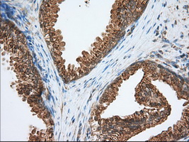 PDE4A / PDE4 Antibody - IHC of paraffin-embedded Human prostate tissue using anti-PDE4A mouse monoclonal antibody. (Dilution 1:50).