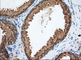 PDE4A / PDE4 Antibody - IHC of paraffin-embedded Human prostate tissue using anti-PDE4A mouse monoclonal antibody. (Dilution 1:50).