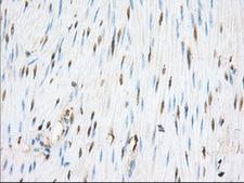 PDE4A / PDE4 Antibody - IHC of paraffin-embedded Human colon tissue using anti-PDE4A mouse monoclonal antibody. (Dilution 1:50).