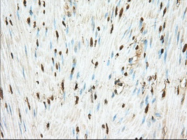 PDE4A / PDE4 Antibody - Immunohistochemical staining of paraffin-embedded Human colon tissue using anti-PDE4A mouse monoclonal antibody. (Dilution 1:50).