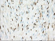 PDE4A / PDE4 Antibody - Immunohistochemical staining of paraffin-embedded Human colon tissue using anti-PDE4A mouse monoclonal antibody. (Dilution 1:50).