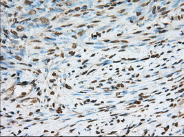 PDE4A / PDE4 Antibody - Immunohistochemical staining of paraffin-embedded Human endometrium tissue using anti-PDE4A mouse monoclonal antibody. (Dilution 1:50).