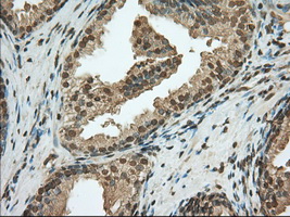 PDE4A / PDE4 Antibody - Immunohistochemical staining of paraffin-embedded Human prostate tissue using anti-PDE4A mouse monoclonal antibody. (Dilution 1:50).