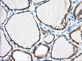 PDE4A / PDE4 Antibody - IHC of paraffin-embedded Human thyroid tissue using anti-PDE4A mouse monoclonal antibody. (Dilution 1:50).