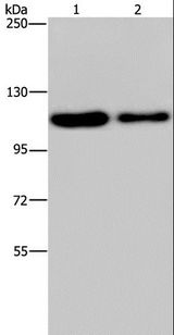 PDE4A / PDE4 Antibody - Western blot analysis of HeLa and A172 cell, using PDE4A Polyclonal Antibody at dilution of 1:300.