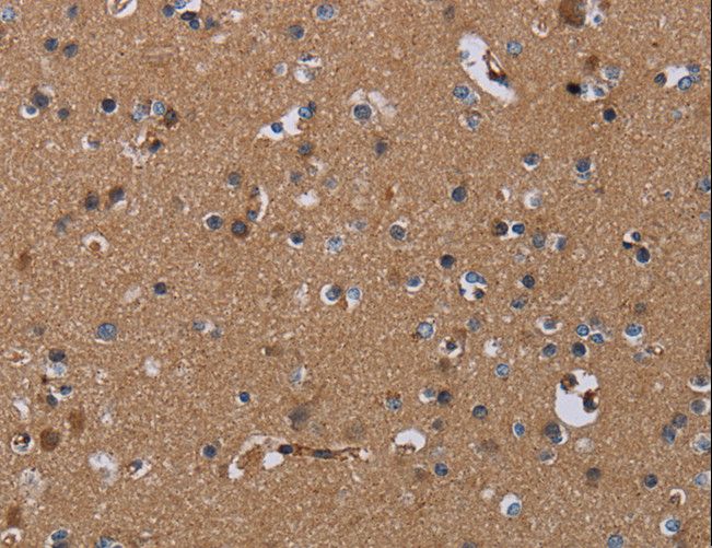 PDE4A / PDE4 Antibody - Immunohistochemistry of paraffin-embedded Human brain using PDE4A Polyclonal Antibody at dilution of 1:40.