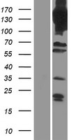 PDE4A / PDE4 Protein - Western validation with an anti-DDK antibody * L: Control HEK293 lysate R: Over-expression lysate