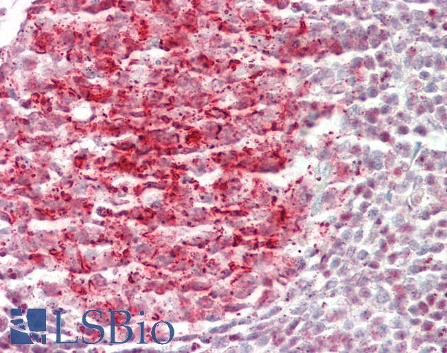 PDE4B Antibody - Human Tonsil: Formalin-Fixed, Paraffin-Embedded (FFPE).  This image was taken for the unconjugated form of this product. Other forms have not been tested.