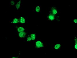 PDE4B Antibody - Anti-PDE4B mouse monoclonal antibody immunofluorescent staining of COS7 cells transiently transfected by pCMV6-ENTRY PDE4B.