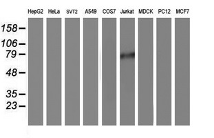 PDE4B Antibody - Western blot of extracts (35 ug) from 9 different cell lines by using anti-PDE4B monoclonal antibody.