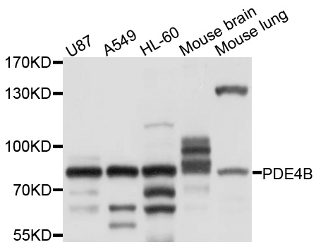 PDE4B Antibody - Western blot analysis of extracts of various cell lines, using PDE4B antibody at 1:1000 dilution. The secondary antibody used was an HRP Goat Anti-Rabbit IgG (H+L) at 1:10000 dilution. Lysates were loaded 25ug per lane and 3% nonfat dry milk in TBST was used for blocking. An ECL Kit was used for detection and the exposure time was 1s.
