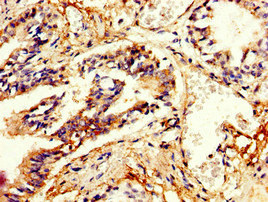 PDE4B Antibody - Immunohistochemistry image of paraffin-embedded human lung tissue at a dilution of 1:100