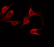 PDE4B+C+D Antibody - Staining HeLa cells by IF/ICC. The samples were fixed with PFA and permeabilized in 0.1% Triton X-100, then blocked in 10% serum for 45 min at 25°C. The primary antibody was diluted at 1:200 and incubated with the sample for 1 hour at 37°C. An Alexa Fluor 594 conjugated goat anti-rabbit IgG (H+L) Ab, diluted at 1/600, was used as the secondary antibody.