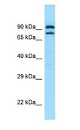 PDE4C Antibody - PDE4C antibody Western Blot of Fetal Lung.  This image was taken for the unconjugated form of this product. Other forms have not been tested.
