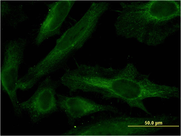 PDE4C Antibody - Immunofluorescence of monoclonal antibody to PDE4C on HeLa cell . [antibody concentration 10 ug/ml]