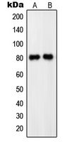 PDE4C Antibody - Western blot analysis of PDE4C expression in HEK293T (A); SHSY5Y (B) whole cell lysates.