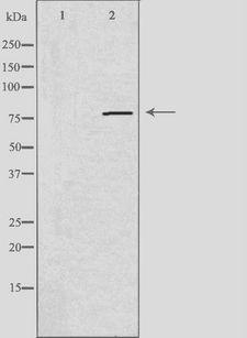 PDE4C Antibody - Western blot analysis of extracts of A549 cells using PDE4C antibody. The lane on the left is treated with the antigen-specific peptide.