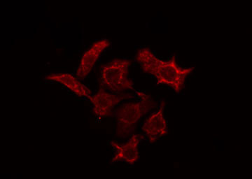 PDE4C Antibody - Staining A549 cells by IF/ICC. The samples were fixed with PFA and permeabilized in 0.1% Triton X-100, then blocked in 10% serum for 45 min at 25°C. The primary antibody was diluted at 1:200 and incubated with the sample for 1 hour at 37°C. An Alexa Fluor 594 conjugated goat anti-rabbit IgG (H+L) antibody, diluted at 1/600, was used as secondary antibody.