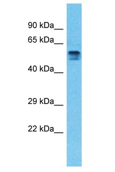 PDE4D Antibody - PDE4D antibody Western Blot of Thymus Tumor. Antibody dilution: 1 ug/ml.  This image was taken for the unconjugated form of this product. Other forms have not been tested.