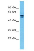 PDE4D Antibody - PDE4D antibody Western Blot of Thymus Tumor. Antibody dilution: 1 ug/ml.  This image was taken for the unconjugated form of this product. Other forms have not been tested.