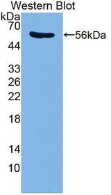 PDE4D Antibody - Western blot of PDE4D antibody.