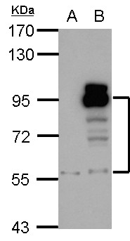PDE4D Antibody - Sample (30 ug of whole cell lysate). A: A431, B: HeLa. 7.5% SDS PAGE. PDE4D antibody diluted at 1:1000.