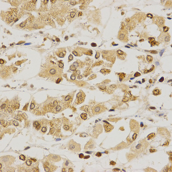 PDE4D Antibody - Immunohistochemistry of paraffin-embedded human stomach using PDE4D antibody at dilution of 1:200 (x400 lens)