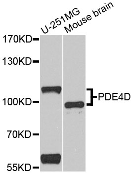 PDE4D Antibody - Western blot analysis of extracts of various cell lines, using PDE4D antibody at 1:1000 dilution. The secondary antibody used was an HRP Goat Anti-Rabbit IgG (H+L) at 1:10000 dilution. Lysates were loaded 25ug per lane and 3% nonfat dry milk in TBST was used for blocking. An ECL Kit was used for detection and the exposure time was 60s.
