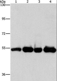 PDE4D Antibody - Western blot analysis of Human bladder carcinoma tissue and A172 cell, human fetal brain tissue and HeLa cell, using PDE4D Polyclonal Antibody at dilution of 1:500.