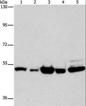 PDE4D Antibody - Western blot analysis of Human bladder carcinoma and brain malignant glioma tissue, A172 cell, human fetal brain tissue and HeLa cell, using PDE4D Polyclonal Antibody at dilution of 1:450.