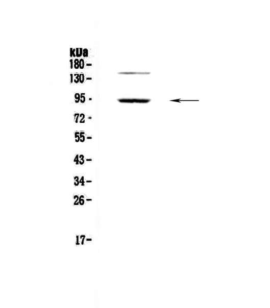 PDE4D Antibody - Western blot - Anti-PDE4D Picoband antibody
