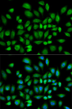 PDE4D Antibody - Immunofluorescence analysis of HeLa cells using PDE4D antibody. Blue: DAPI for nuclear staining.